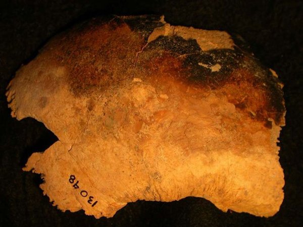 Parietal derecho de un cráneo adulto que muestra marcas de quemaduras. resistencia contra zombies en la Inglaterra medieval