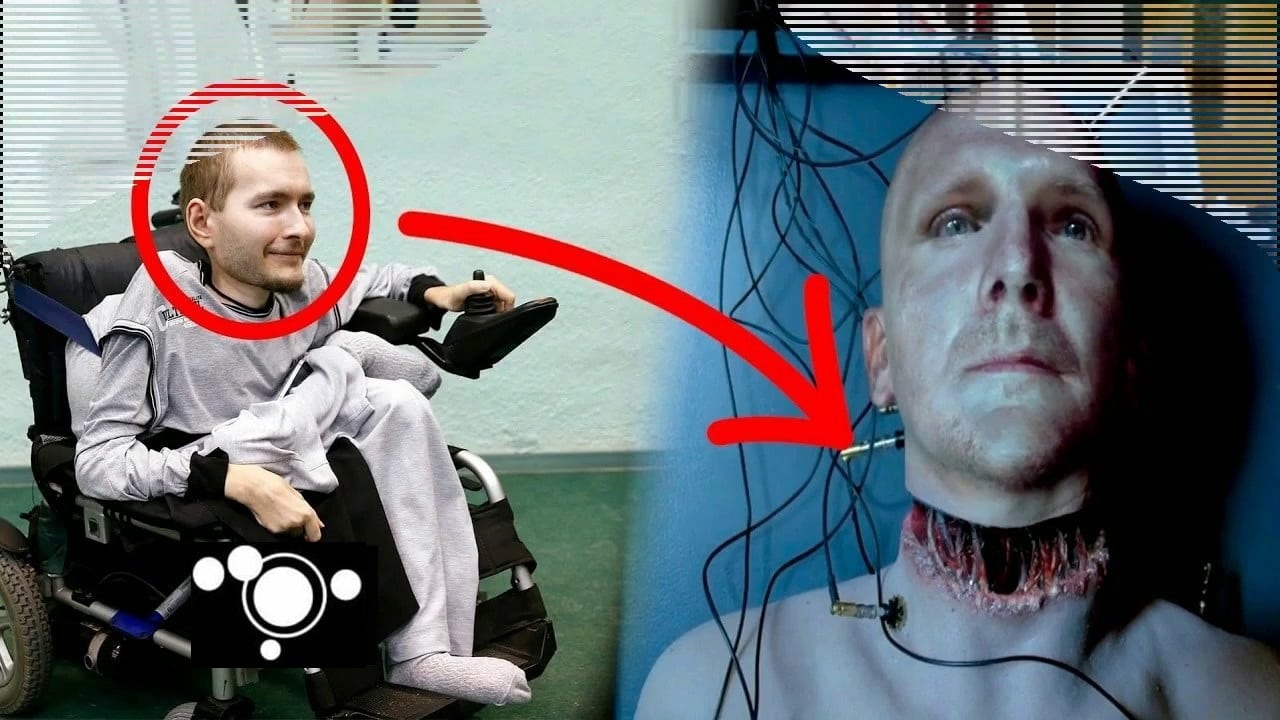 https://www.infinityexplorers.com/last-minute-scientists-achieve-first-successful-human-head-transplant-video https://www.infinityexplorers.com/last-minute-scientists-achieve-first-successful-human-head-transplant-video