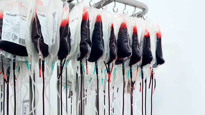 Sangre Dorada, sólo 43 personas la tienen en todo el mundo