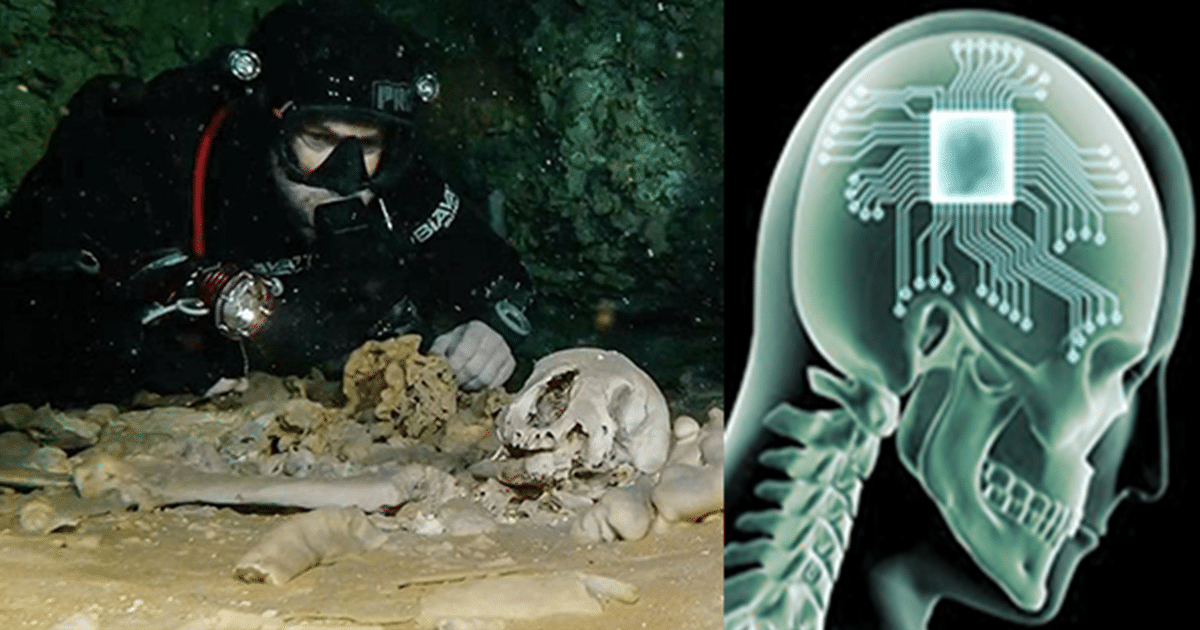 Descubrió un cráneo de 12.000 años con un implante de microchip